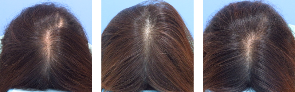 初診時7ヵ月後13ヵ月後