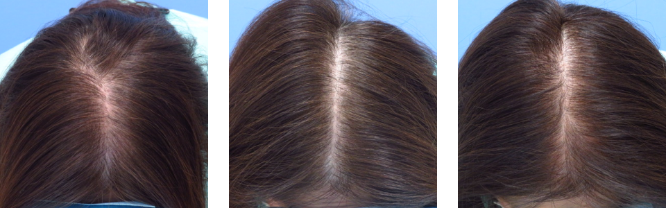 初診時8ヵ月後14ヵ月後