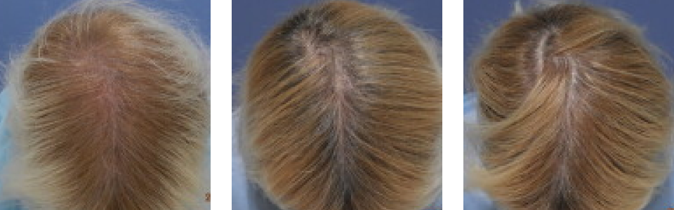 初診時3ヵ月後5ヵ月後