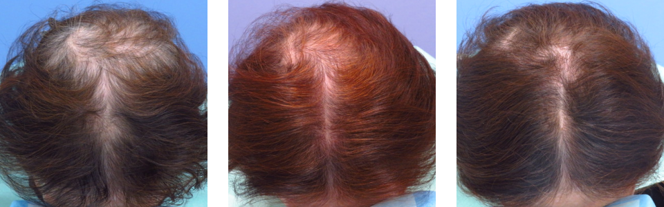 初診時3ヵ月後6ヵ月後