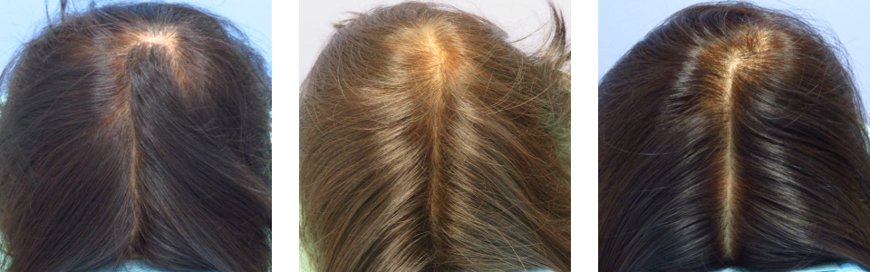 初診時4ヵ月後10ヵ月後