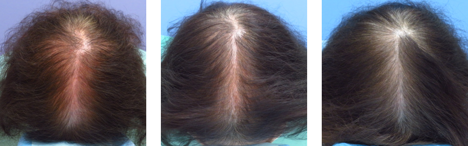 初診時4ヵ月後14ヵ月後