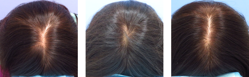 初診時6ヵ月後13ヵ月後