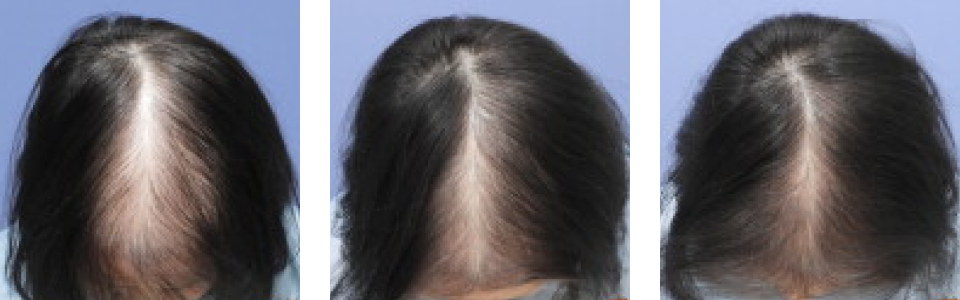 初診時3ヵ月後5ヵ月後