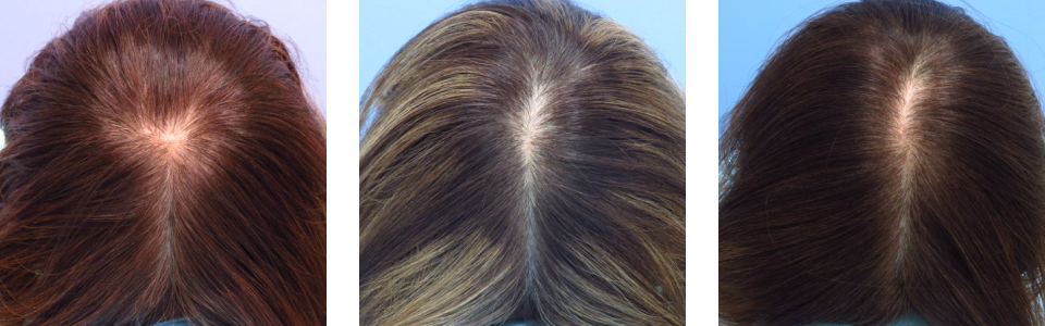 初診時6ヵ月後16ヵ月後