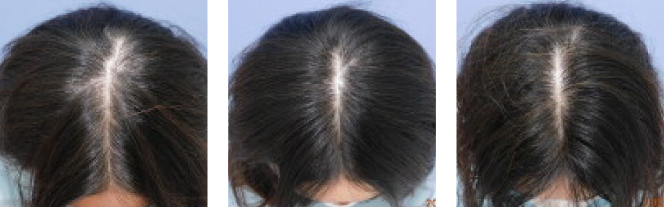 初診時3ヵ月後5ヵ月後