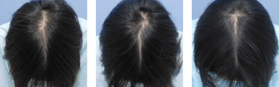 初診時3ヵ月後5ヵ月後