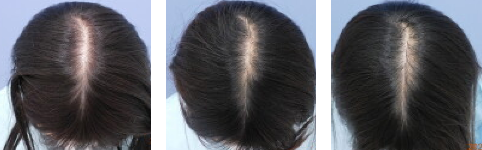 初診時3ヵ月後6ヵ月後