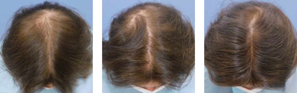 初診時3ヵ月後5ヵ月後