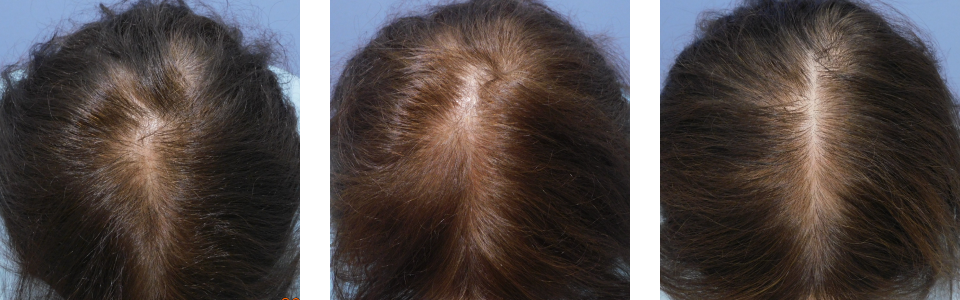 初診時3ヵ月後6ヵ月後