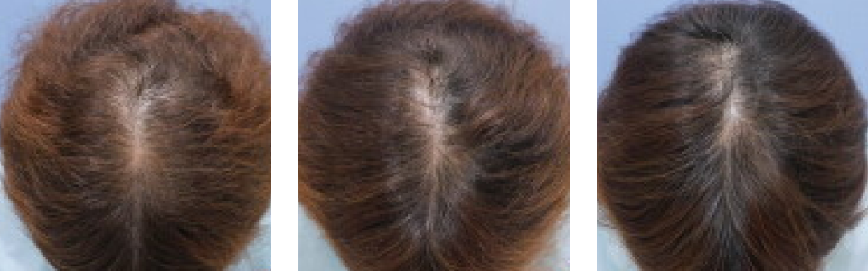 初診時3ヵ月後6ヵ月後