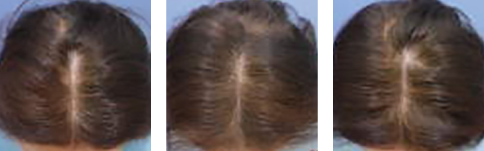 初診時2ヵ月後6ヵ月後