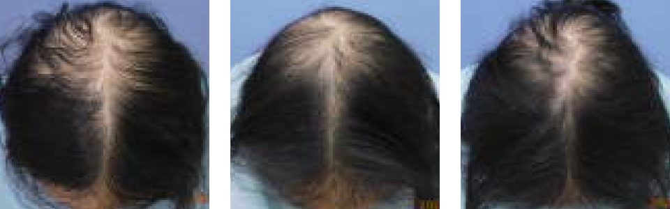 初診時4ヵ月後8ヵ月後