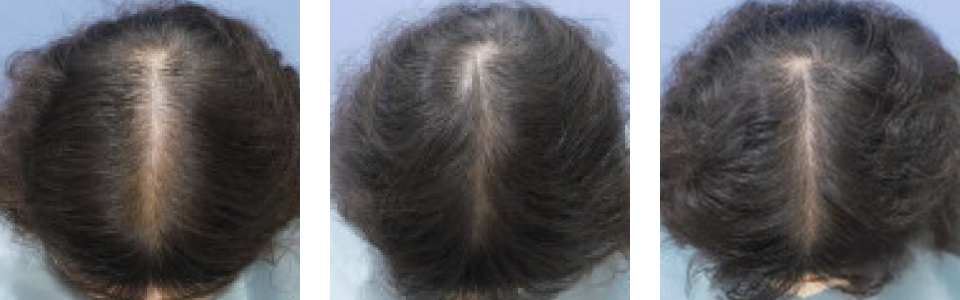 初診時5ヵ月後11ヵ月後