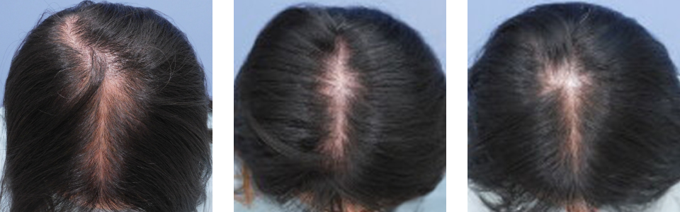 初診時6ヵ月後12ヵ月後