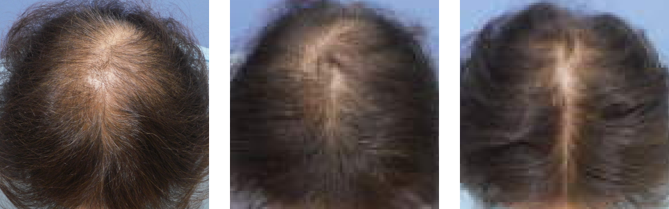 初診時3ヵ月後8ヵ月後