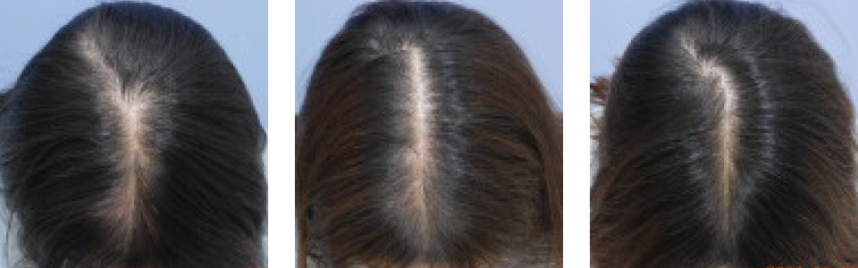 初診時4ヵ月後9ヵ月後