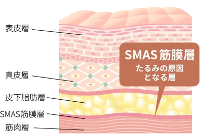 顔の筋膜を引き締める